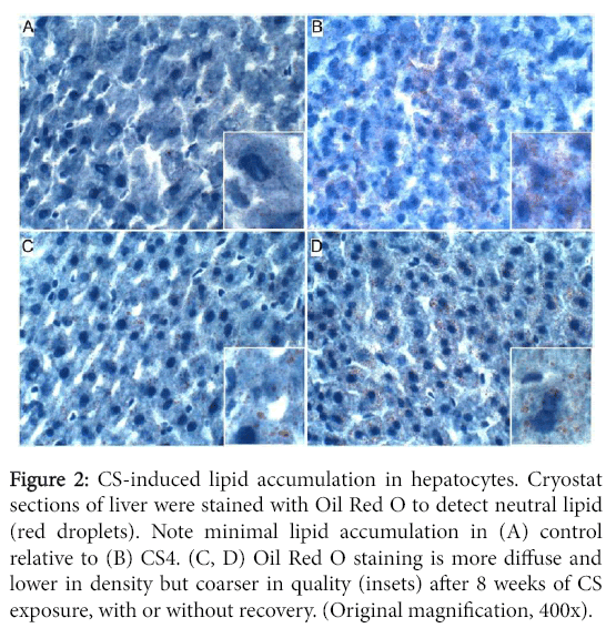 clinical-experimental-pathology-CS-induced-lipid-accumulation