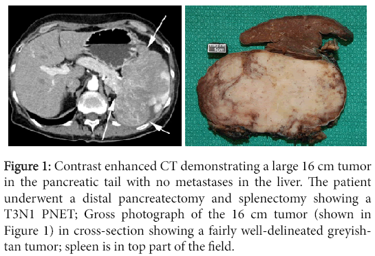 clinical-experimental-pathology-Contrast-enhanced