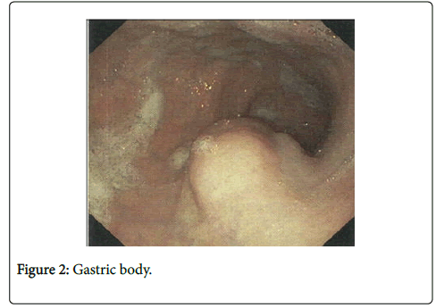 clinical-experimental-pathology-Gastric-body