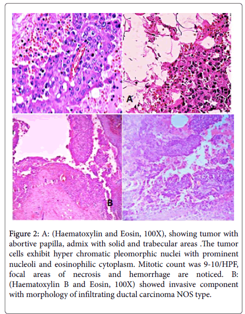 clinical-experimental-pathology-Haematoxylin-Eosin