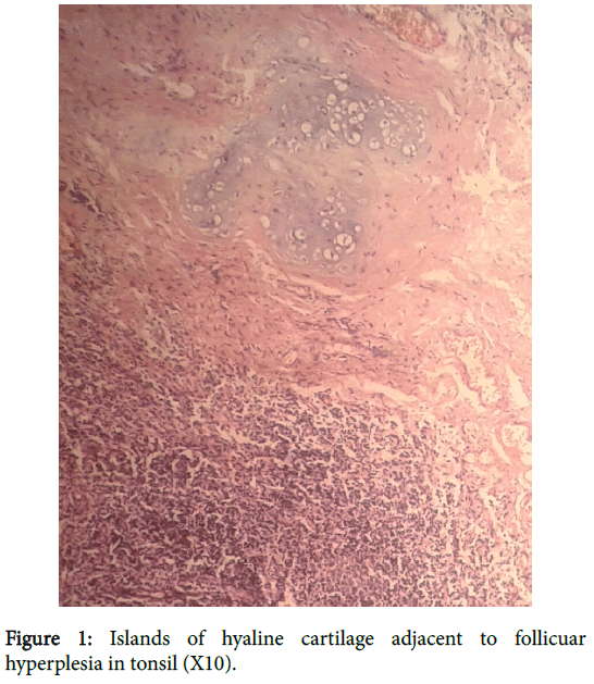 clinical-experimental-pathology-Islands-hyaline-cartilage