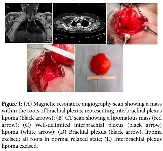 clinical-experimental-pathology-Magnetic-resonance-angiography