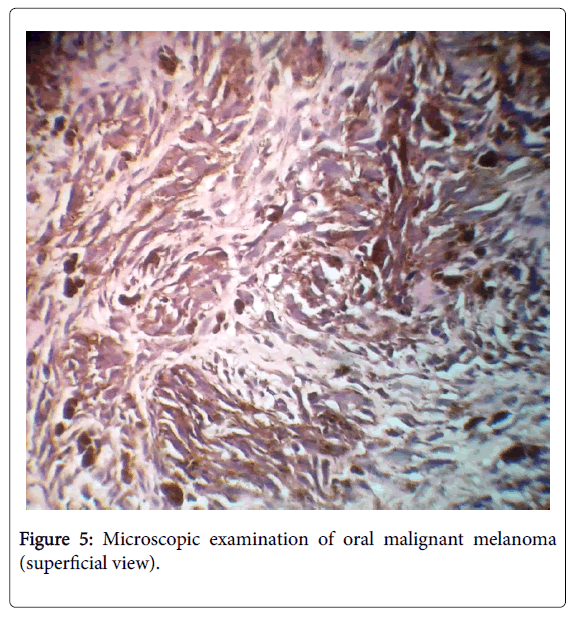 clinical-experimental-pathology-Microscopic-examination-oral