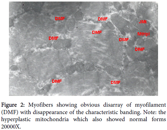 clinical-experimental-pathology-Myofibers-showing-obvious
