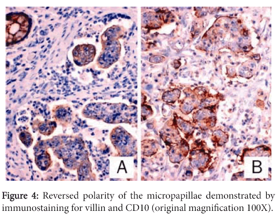 clinical-experimental-pathology-Reversed-polarity