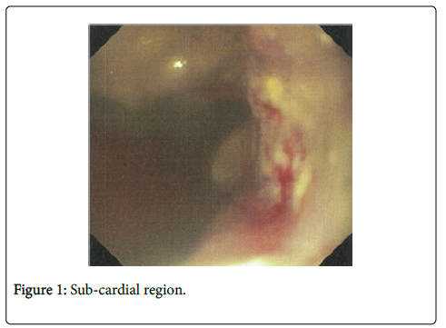 clinical-experimental-pathology-Sub-cardial
