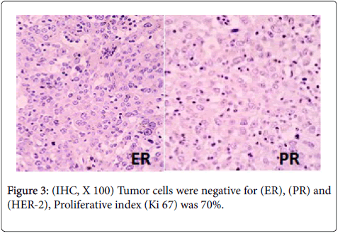 clinical-experimental-pathology-Tumor-cells