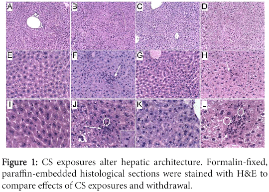 clinical-experimental-pathology-alter-hepatic-architecture