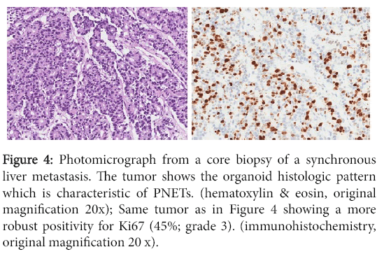 clinical-experimental-pathology-core-biopsy