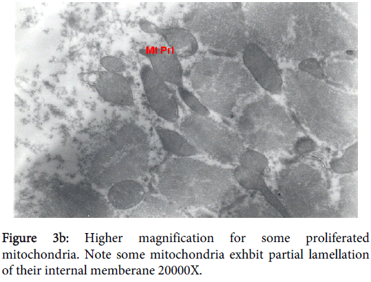 clinical-experimental-pathology-exhbit-partial-lamellation
