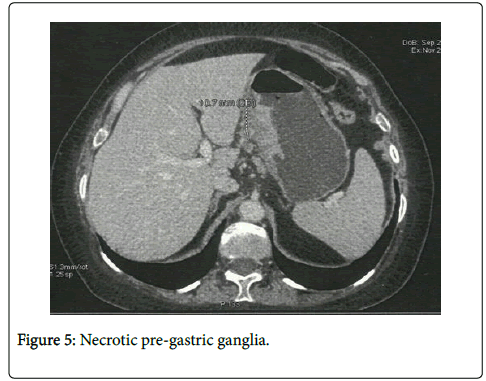 clinical-experimental-pathology-gastric-ganglia