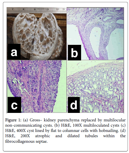 clinical-experimental-pathology-kidney-parenchyma