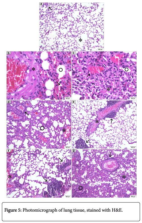 clinical-experimental-pathology-lung-tissue