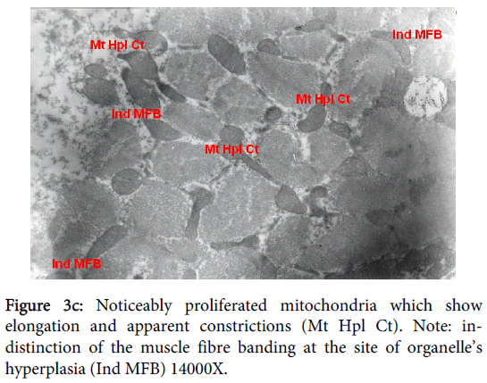clinical-experimental-pathology-muscle-fibre-banding