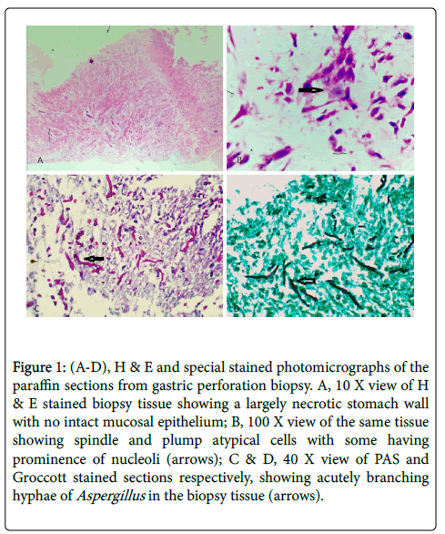 clinical-experimental-pathology-stained-photomicrographs