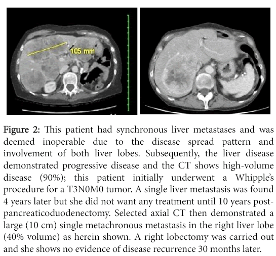 clinical-experimental-pathology-synchronous-liver