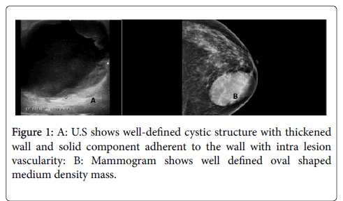 clinical-experimental-pathology-well-defined-cystic