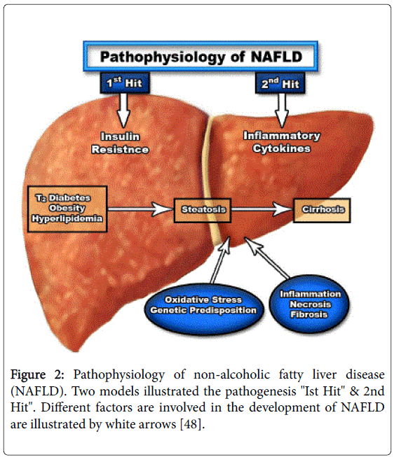 pathophysiology of liver disease and key liver function biology essay Despite epochal progress in the treatment of hepatitis c virus infections, pharmacological treatment strategies for most liver diseases are still limited and new targets for prevention or treatment of liver disease are urgently needed. pathophysiology of liver disease and key liver function biology essay Despite epochal progress in the treatment of hepatitis c virus infections, pharmacological treatment strategies for most liver diseases are still limited and new targets for prevention or treatment of liver disease are urgently needed.