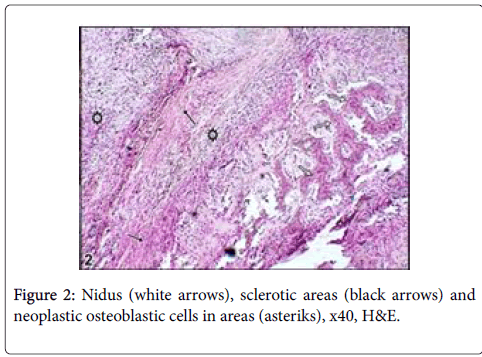 clinical-experimental-sclerotic-areas