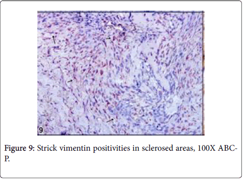 clinical-experimental-vimentin