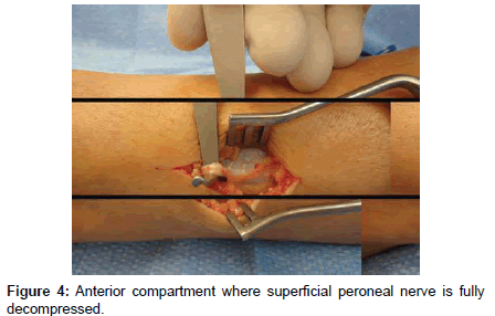 clinical-foot-ankle-Anterior