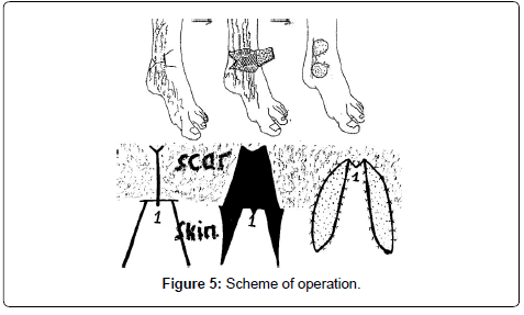 clinical-foot-ankle-Scheme-operation