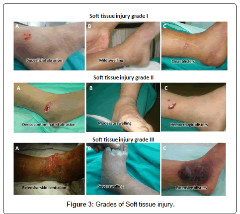 clinical-foot-ankle-Soft-injury