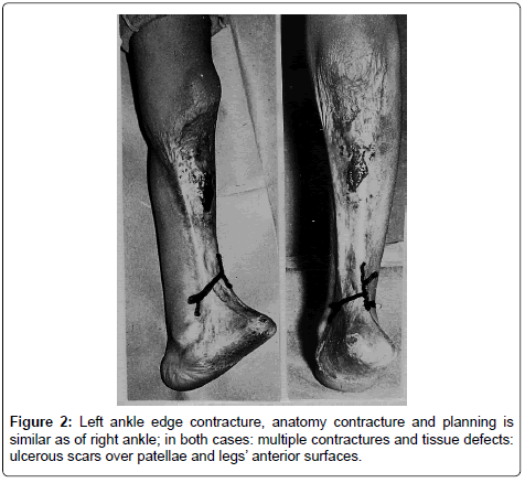 clinical-foot-ankle-anatomy-tissue