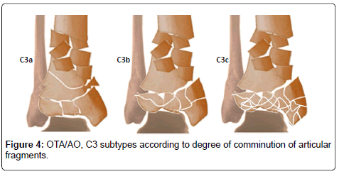 clinical-foot-ankle-articular-fragments
