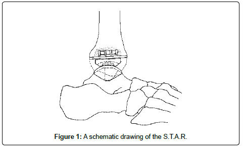 clinical-foot-ankle-drawing