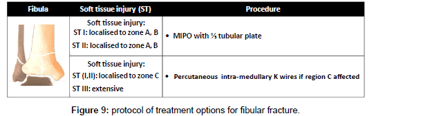 clinical-foot-ankle-fibular-fracture