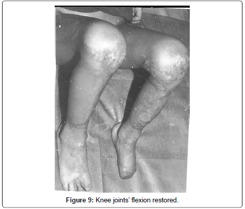clinical-foot-ankle-flexion-joints