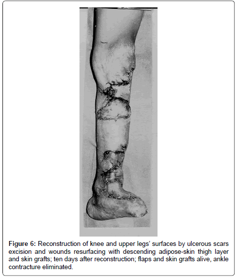 clinical-foot-ankle-grafts-alive