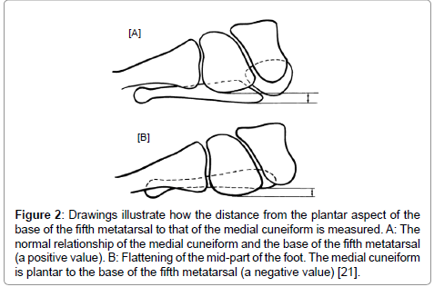clinical-foot-ankle-negative-value