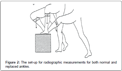 clinical-foot-ankle-normal-ankles