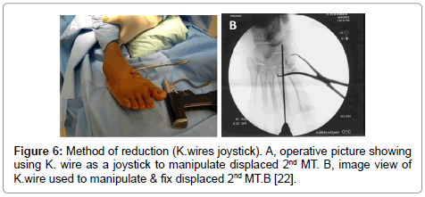 clinical-foot-ankle-picture-joystick