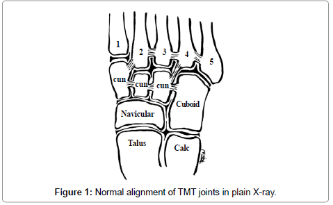 clinical-foot-ankle-plain-joints
