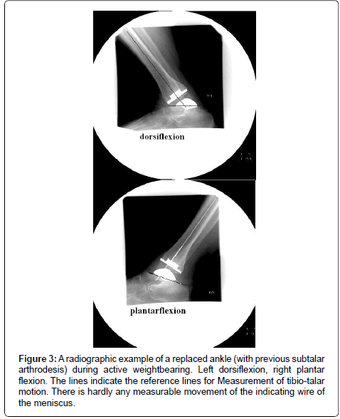clinical-foot-ankle-radiographic