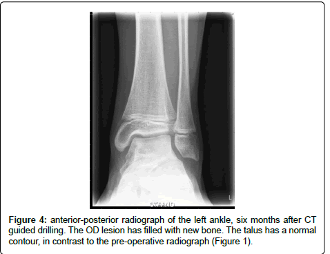 clinical-foot-ankle-radiographl