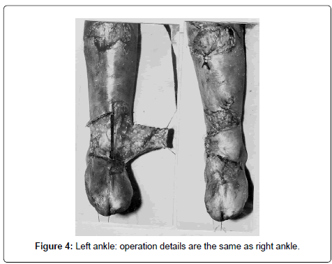 clinical-foot-ankle-right-ankle