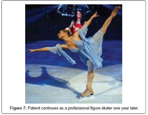 clinical-foot-ankle-skater-later