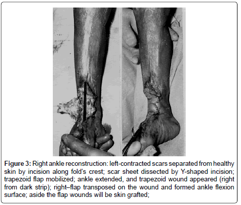 clinical-foot-ankle-skin-wounds