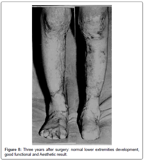 clinical-foot-ankle-surgery-lower