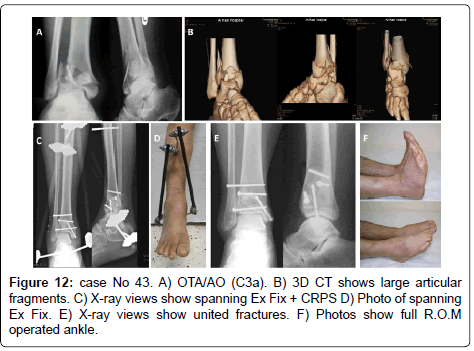 clinical-foot-ankle-united-Photos