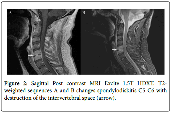 clinical-infectious-diseases-Sagittal-Post