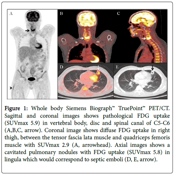 clinical-infectious-diseases-Whole-body