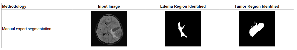 segmentation