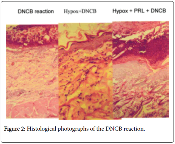 clinical-neuroimmunology-Histological-photographs