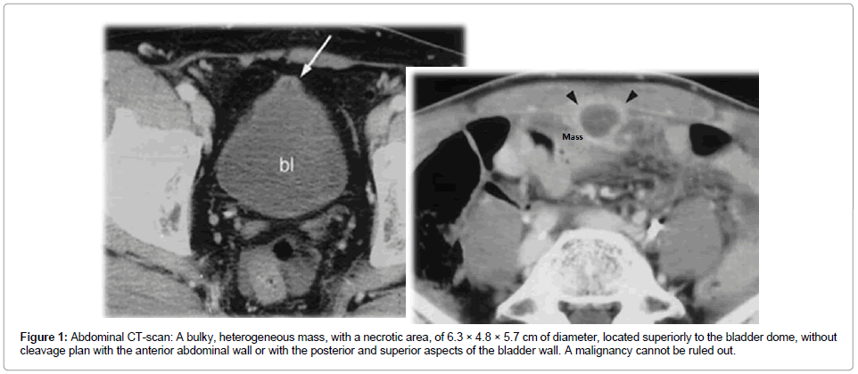 clinical-pathology-Abdominal-CT-scan