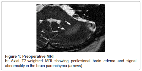 clinical-pathology-Axial-T2-weighted